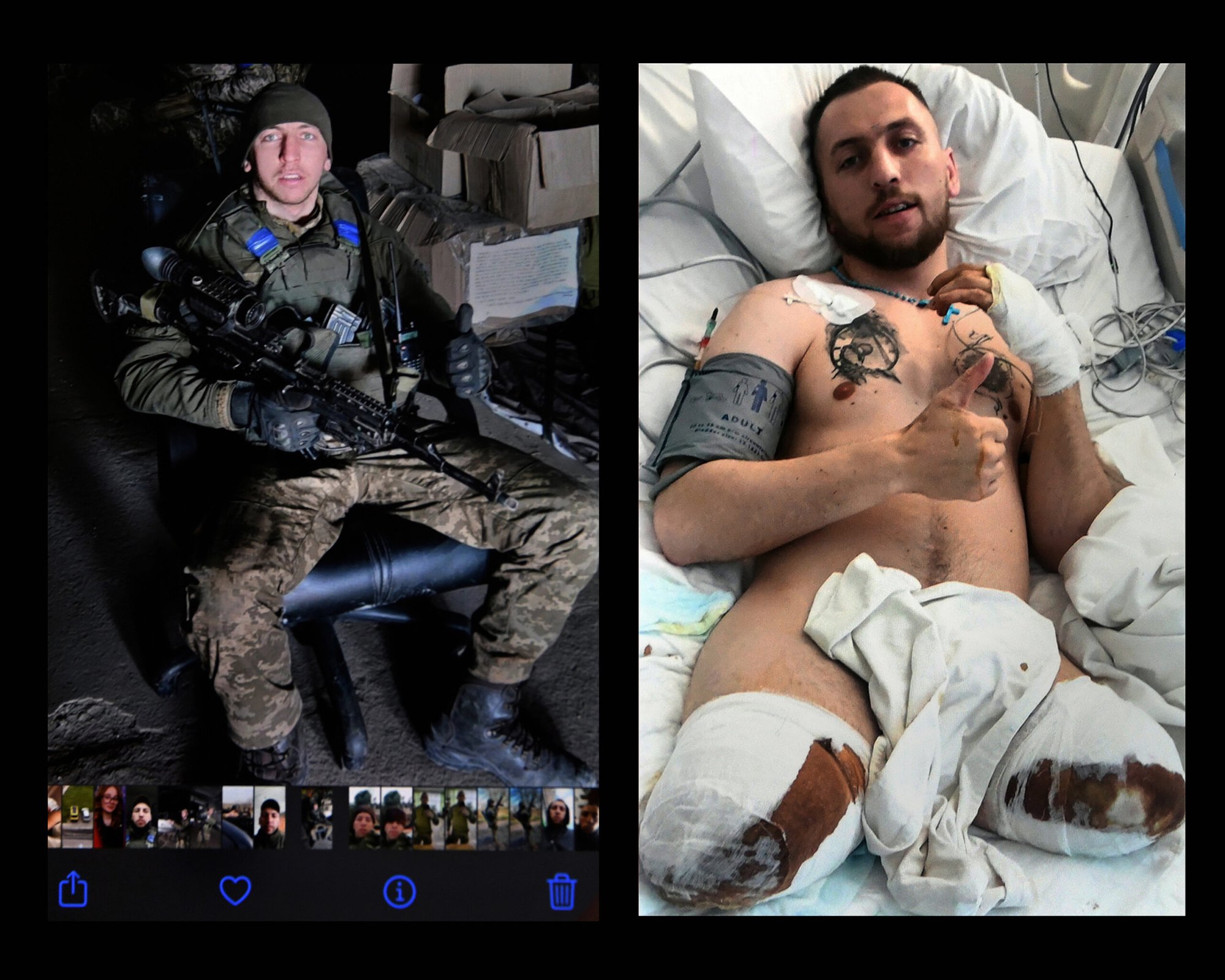 A composite photo of injured Ukrainian soldier with amputed legs and a mobile screenshot of him earlier in combat gear and a rifle with thermal scope.