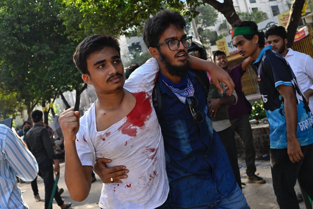 A young man helps an injured protester in a blood-stained t-shirt to the Dhaka Medical College emergency unit after a clash between students and government supporters during a demonstration in Dhaka, Bangladesh.